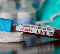 Coronavirus : le bilan passe à 89 cas de contamination
