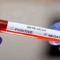 Coronavirus : Un seul nouveau cas enregistré le 20 Juin 2020