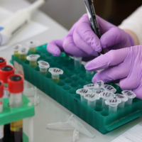 Covid-19 : Six laboratoires privés ont commencé à effectuer les tests RT-PCR