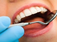 Le tarif minimum d'une consultation chez un dentiste fixé à 30 dinars